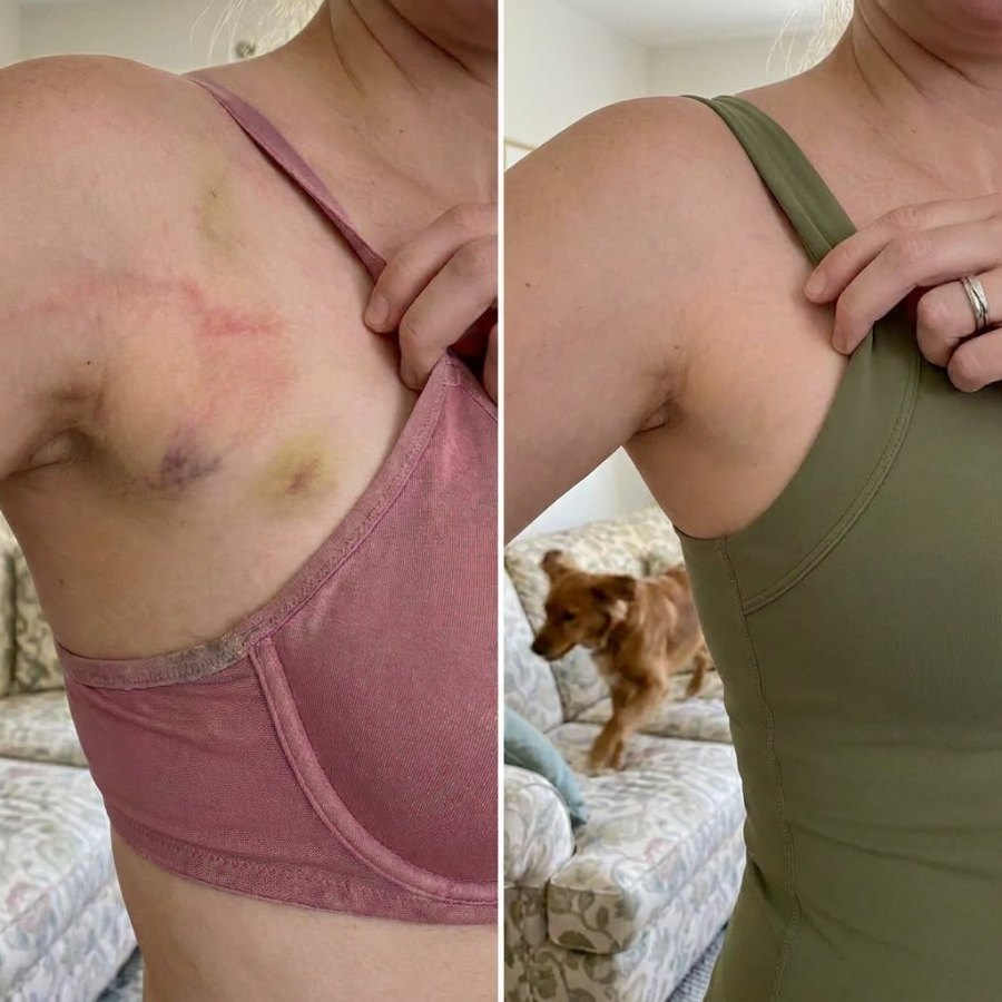 Bra strap marks under the arm, then the same spot in the tank