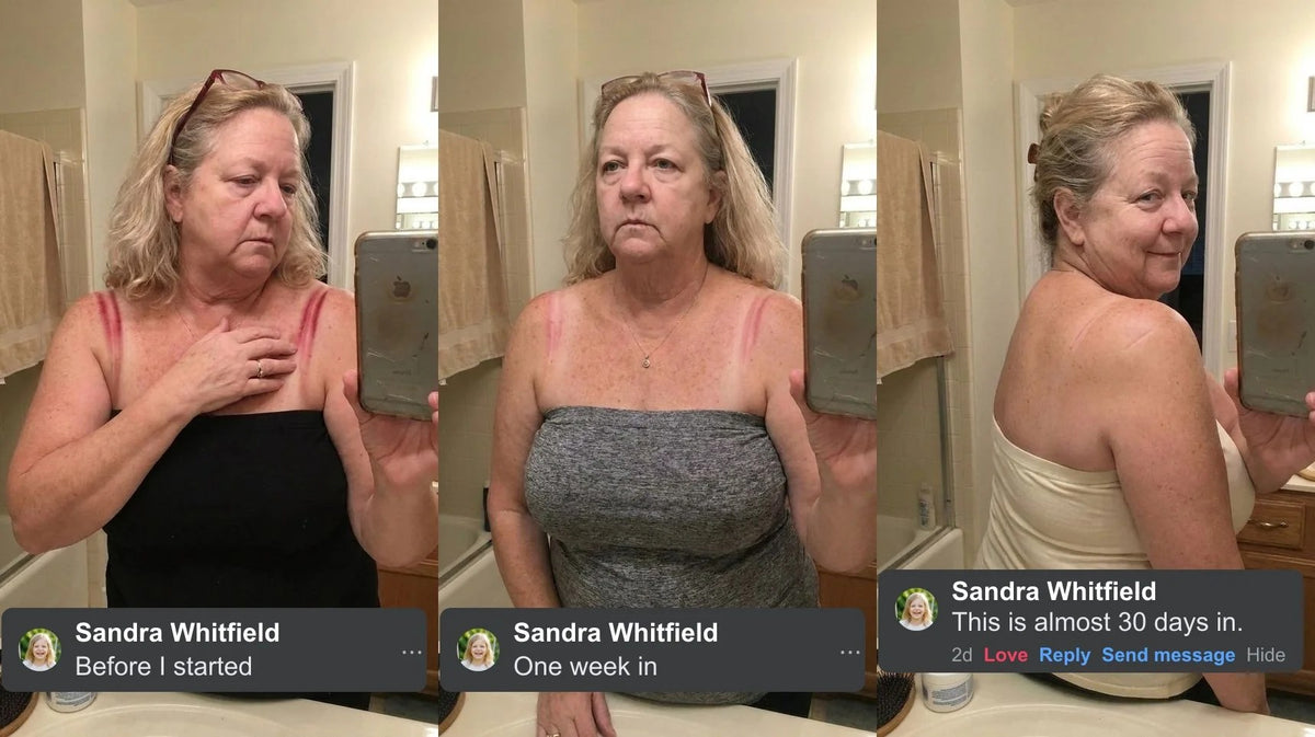 Customer bra strap marks fading over 30 days in Maggie's Tank