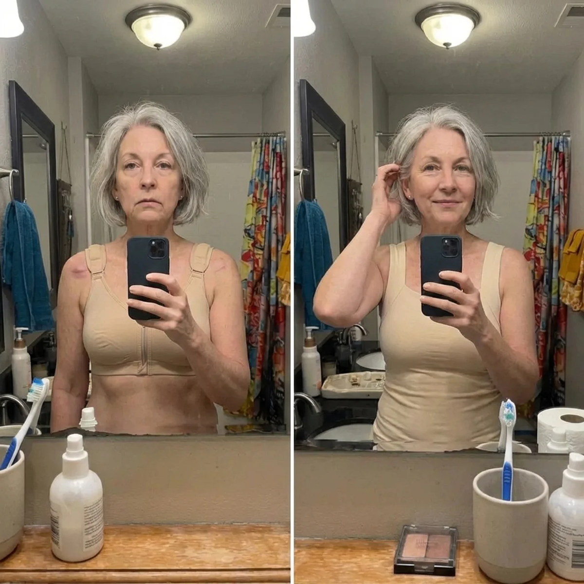 Left, a woman in a post-surgical compression bra after a mastectomy. Right, the same woman wearing the comfort tank.