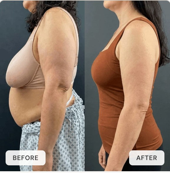 Side profile in an old bra, then in the tank